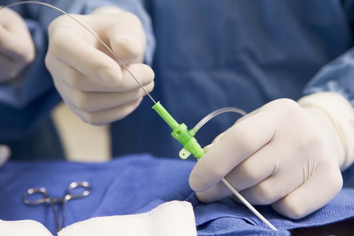 Endovascular surgery